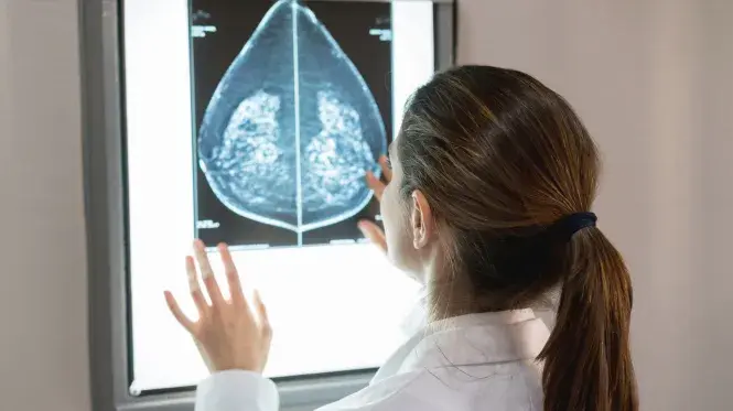 A provider looks at a mammogram scan on a screen