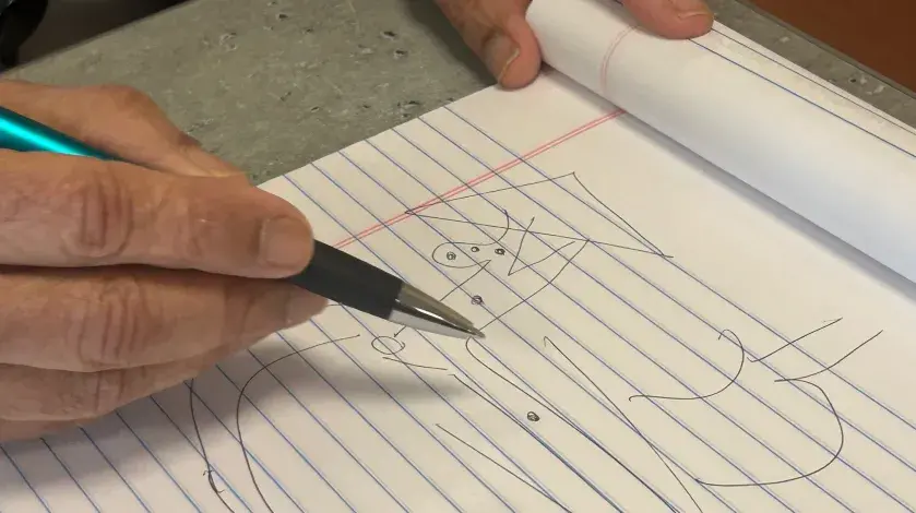 Prakash Rau, MD sketches the GI tract on notebook paper