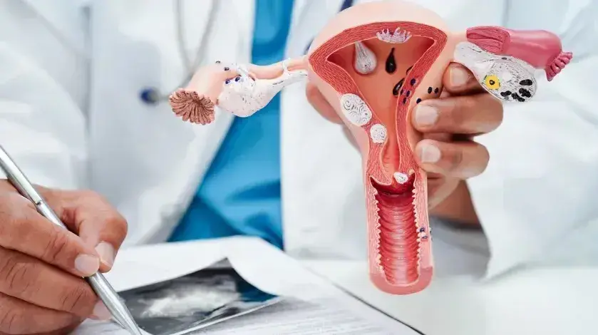 A provider holds a model of female reproductive organs